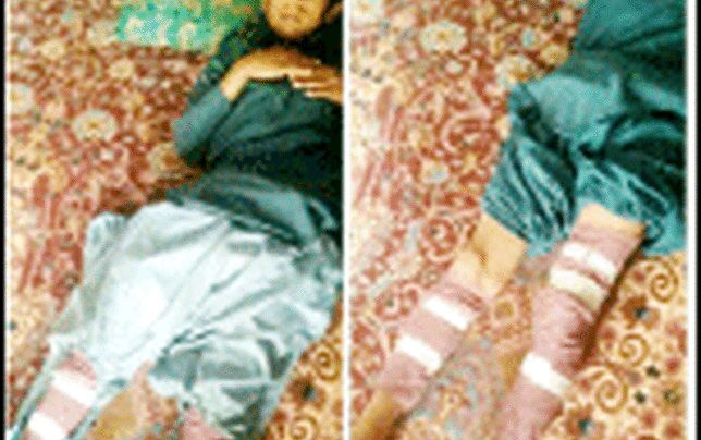 جزئیات دو حادثه آتشین در زهک