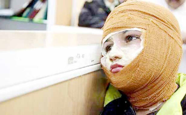 
هزینه یک‌بار پانسمان سوختگی هفت میلیون تومان  است