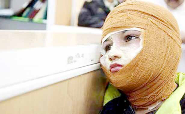 
هزینه یک‌بار پانسمان سوختگی هفت میلیون تومان  است
