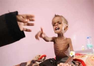 سازمان ملل: شاهد فاز جدید قحطی در یمن هستیم 