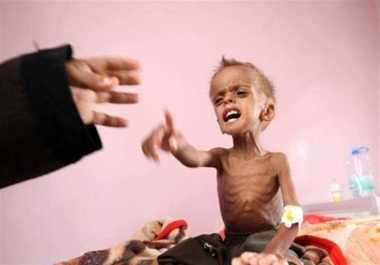 سازمان ملل: شاهد فاز جدید قحطی در یمن هستیم 
