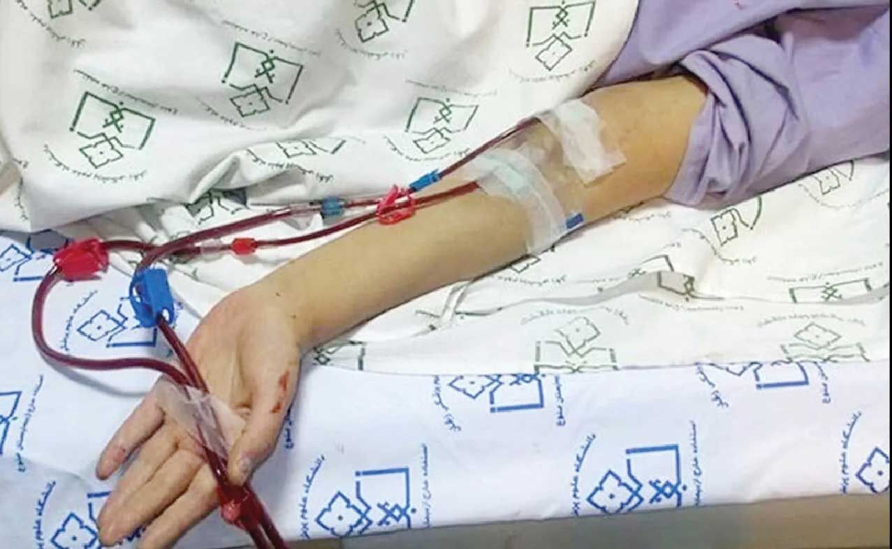 
بیماران پیوندی در معرض خطر رد عضو