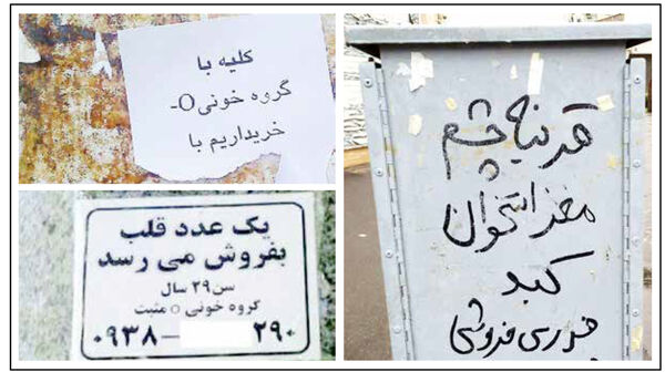 
حراج عضو در ازای چند میلیون پول ناقابل!