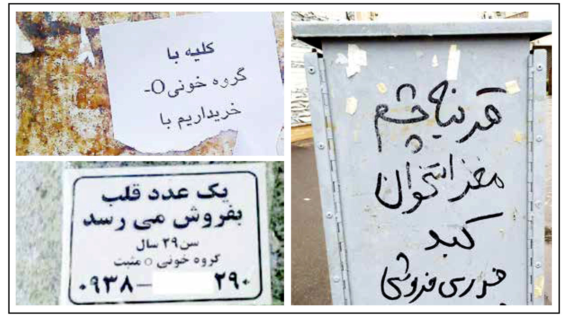 
حراج عضو در ازای چند میلیون پول ناقابل!