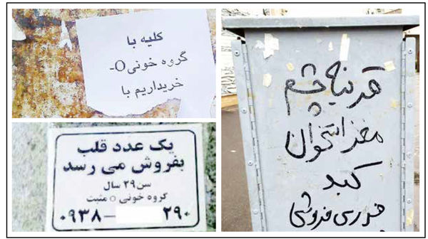 
حراج عضو در ازای چند میلیون پول ناقابل!