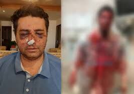 دستگیری ضاربان پزشک متخصص
