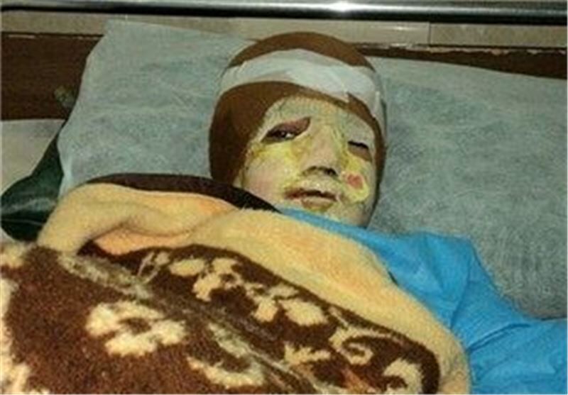 رویای سوخته دختری که می‌خواست بازیگر شود