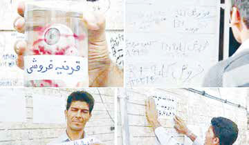 
کلیه با نرخ دولتی هم عرضه می‌شود!
