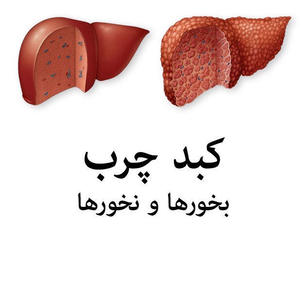 پیشگیری از کبدچرب با سبزیجات پهن‌برگ