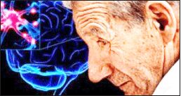 درمان پارکینسون با کاشت الکترود در مغز