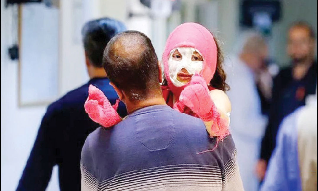 
دست و صورت؛ بیشترین سوختگی‌ها در حوادث چهارشنبه‌سوری
