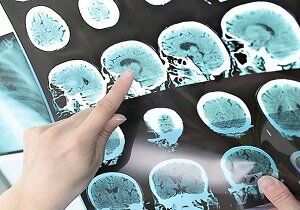 یک میلیون ماهانه می‌پردازم تا بیماری‌ام پنهان بماند